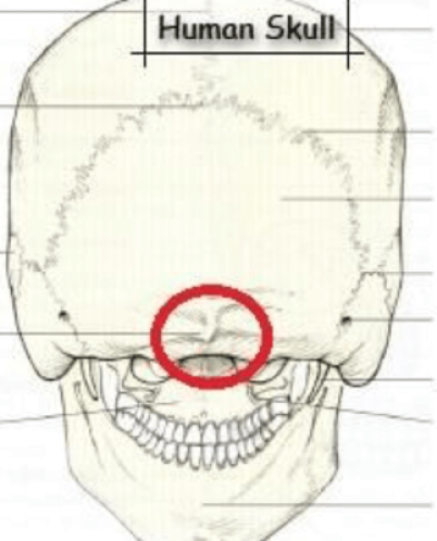 Typical inion compared to Starchild Skull