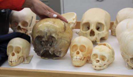 Comparison of the Starchild Skull to human and adult skulls, photo credit: Chase Kloetzke